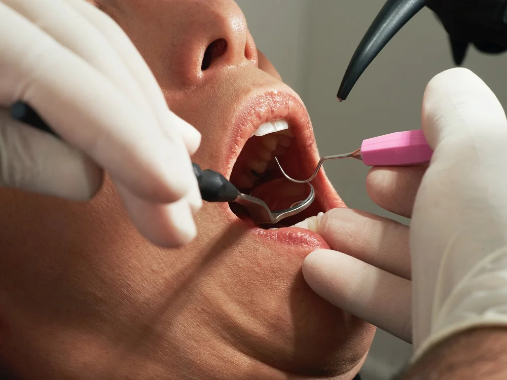 Conquering Dental Anxiety at Alta Dentistry: Experience Comfortable, Stress-Free Dental Care in Tijuana, Mexico